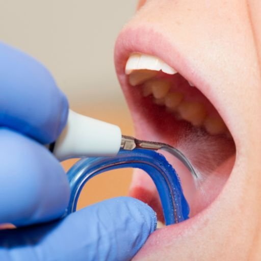 Limpieza-dental.jpg